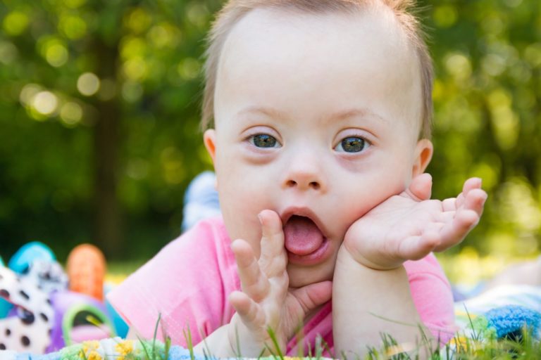 Portrait of Cute baby boy with Down syndrome lying on blanket in summer